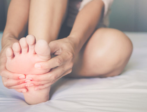 Bolhas nos pés: como evitar e tratar esse problema